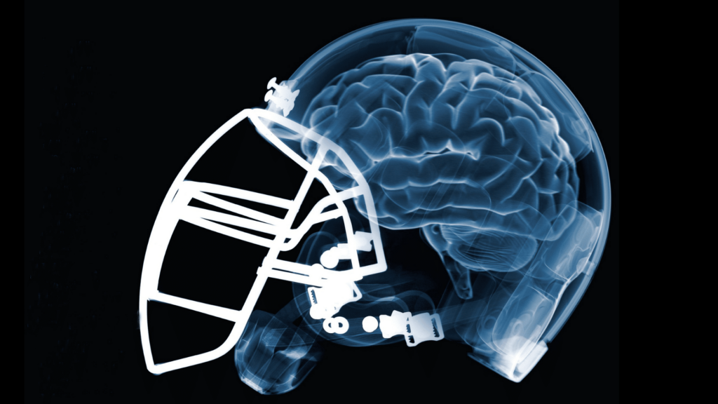 Brain in football helmet to represent a Sports concussions